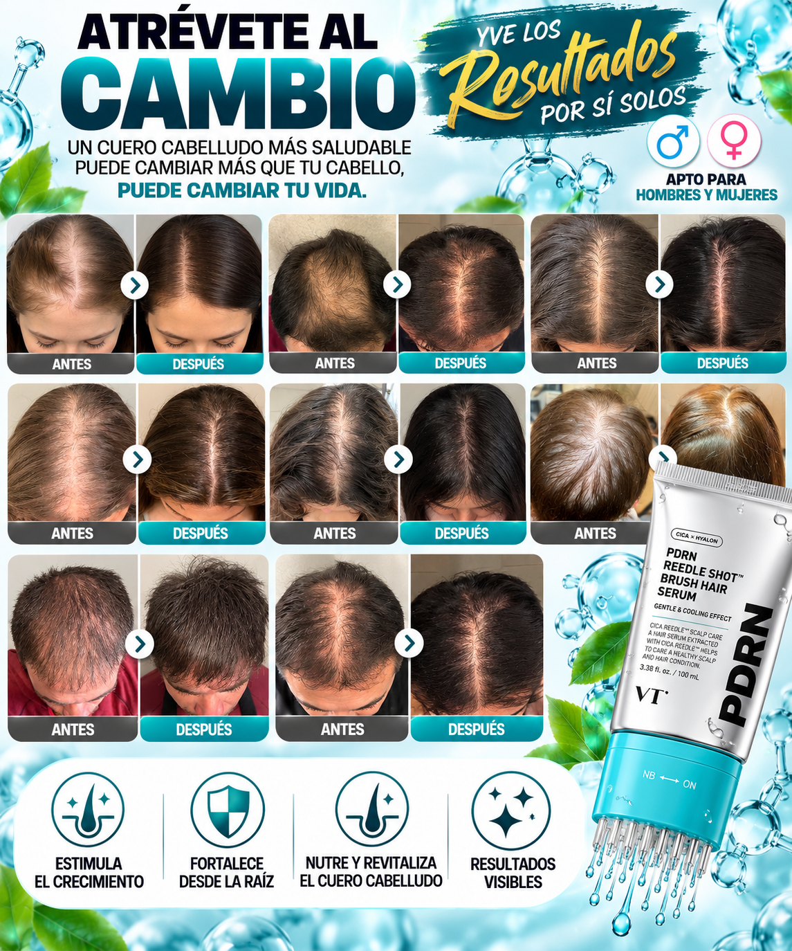 Únete a cientos de personas que han logrado recuperar su cabello y confianza!